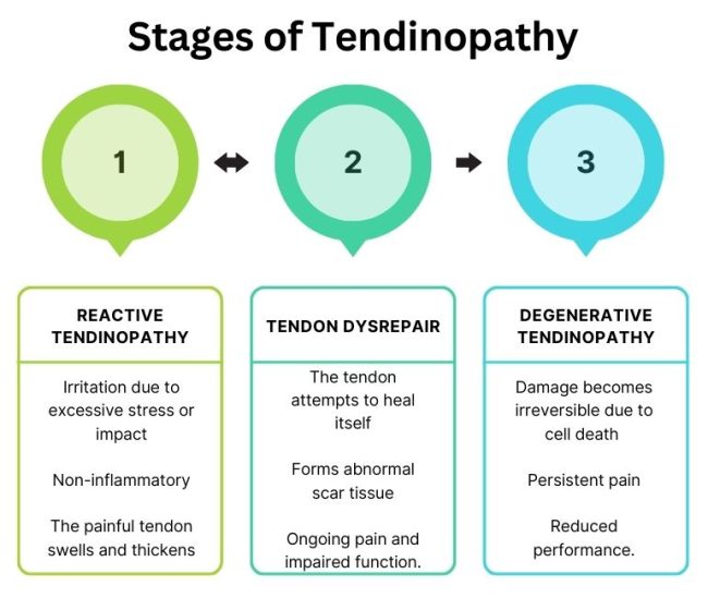 All About Tendinopathy | Pure Physio