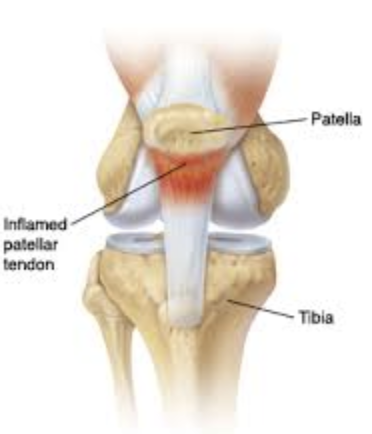 Knee Injuries From Cycling | Pure Physio